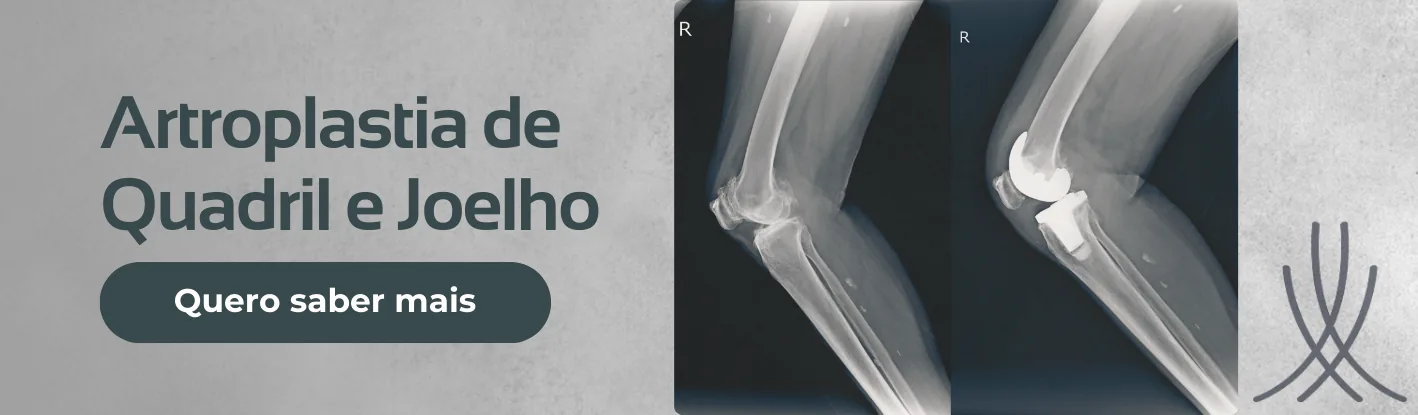Artroplastia de Quadril e Joelho